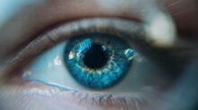 blue eye photo