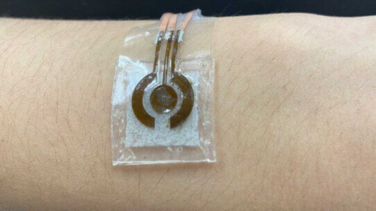 Glucosesensor