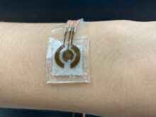 Glucosesensor