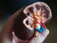 kidney scale model in hand
