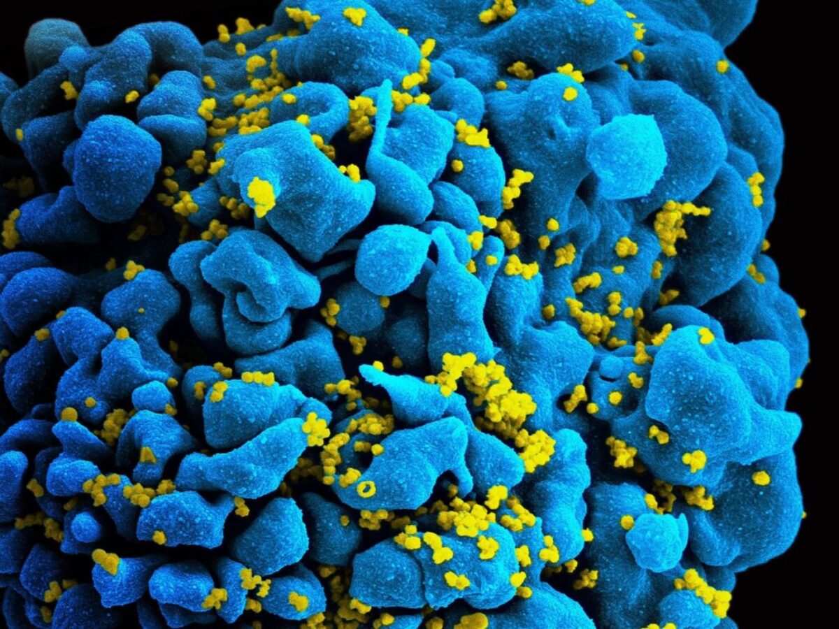 První žena byla vyléčena z HIV.