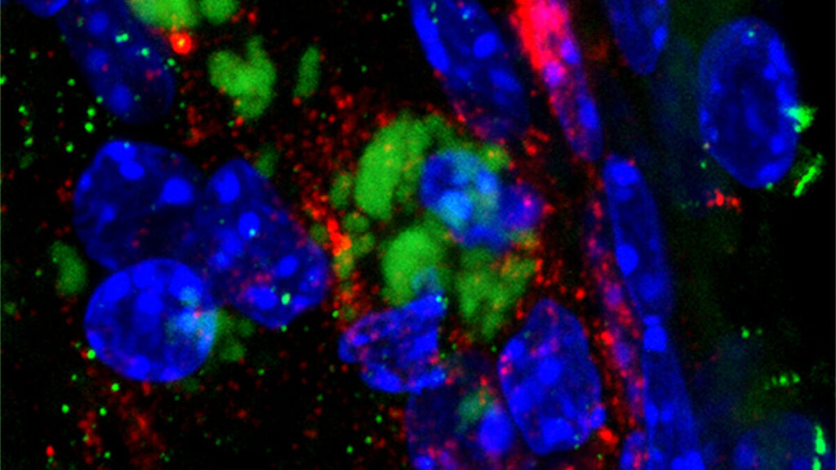 amyloid-peptide-1