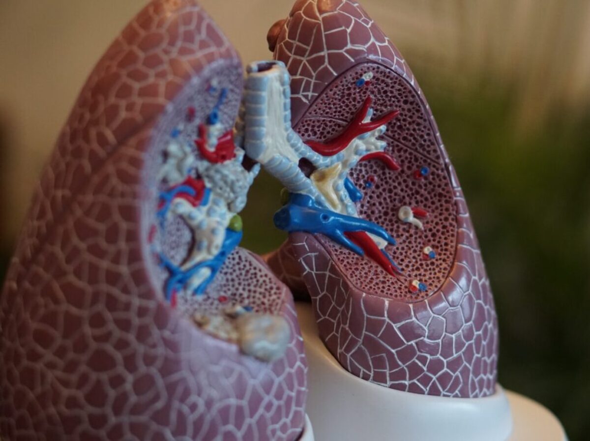 selective focus photography of anatomy lungs