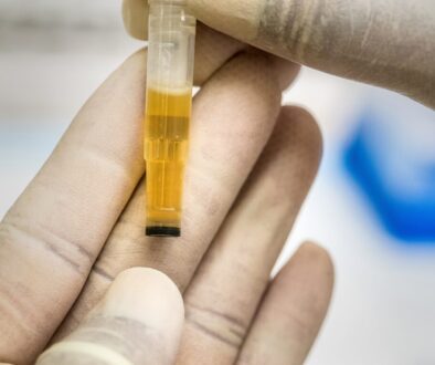 person holding yellow and clear tube
