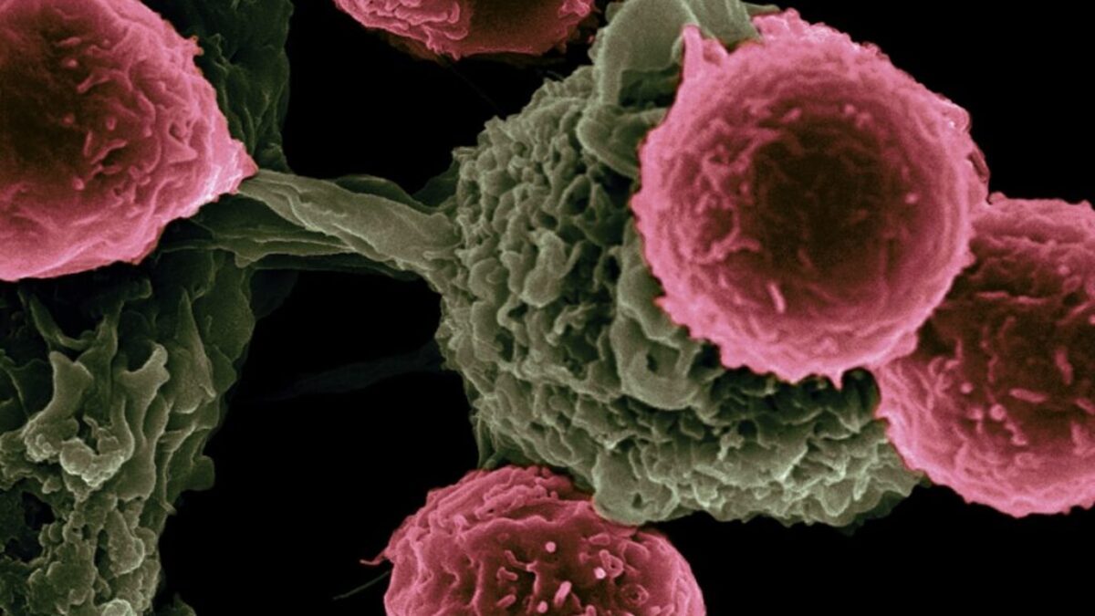 National Cancer Institute