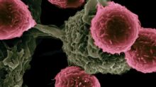 National Cancer Institute