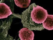 National Cancer Institute
