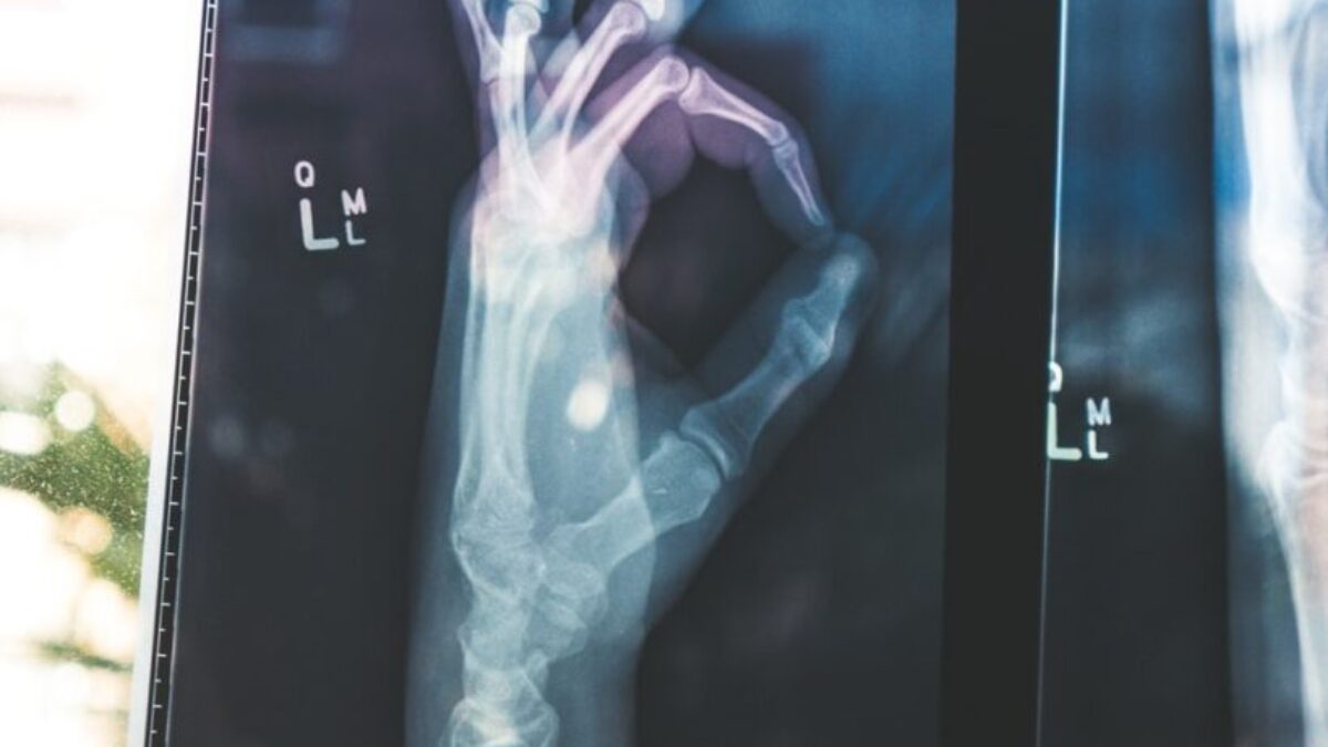 citiscan result hand ok