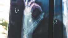 citiscan result hand ok