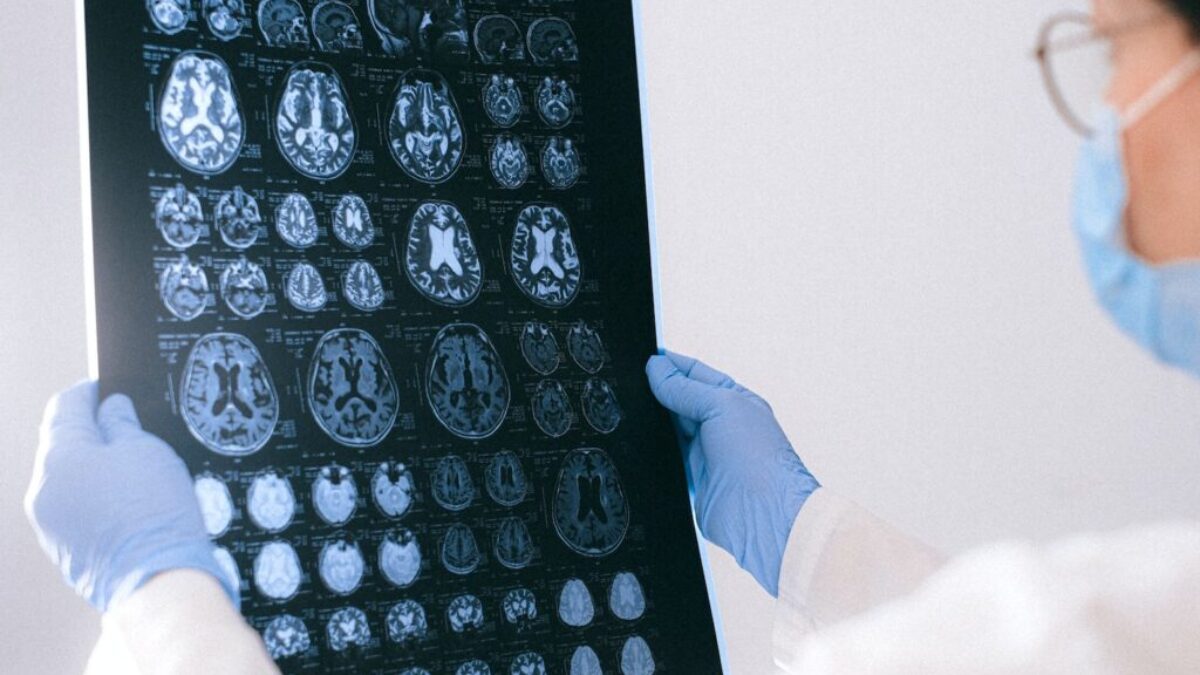 A Doctor Holding an MRI Result of the Brain