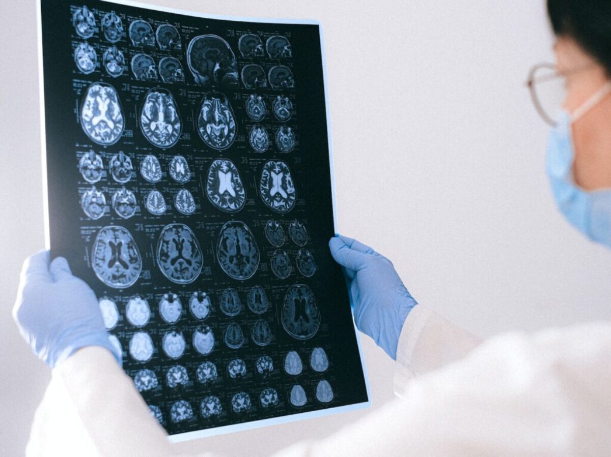 A Doctor Holding an MRI Result of the Brain