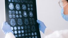 A Doctor Holding an MRI Result of the Brain