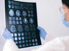 A Doctor Holding an MRI Result of the Brain