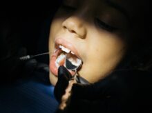 Close-Up Shot of a Kid Having Dental Checkup