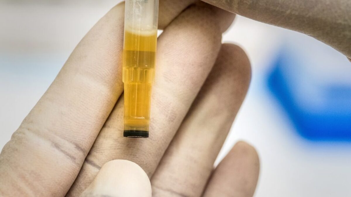 person holding yellow and clear tube