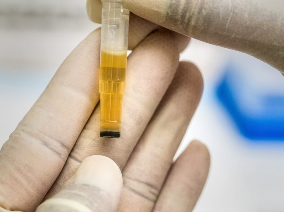 person holding yellow and clear tube