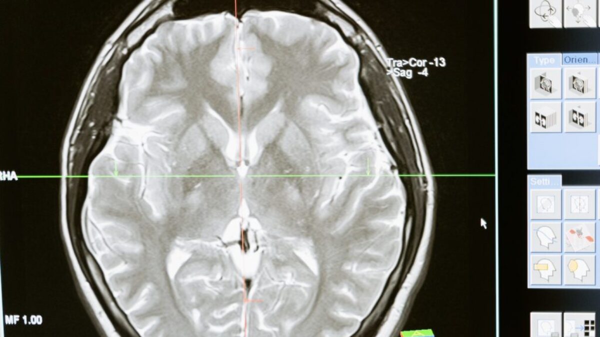 Free stock photo of analysis, anatomy, brain