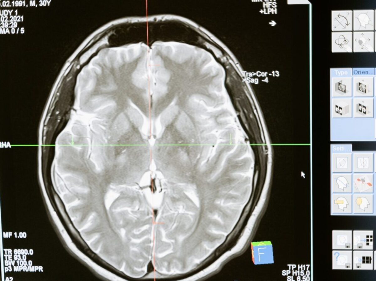 Free stock photo of analysis, anatomy, brain