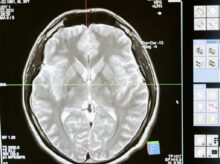 Free stock photo of analysis, anatomy, brain