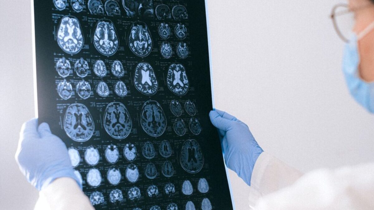 A Doctor Holding an MRI Result of the Brain