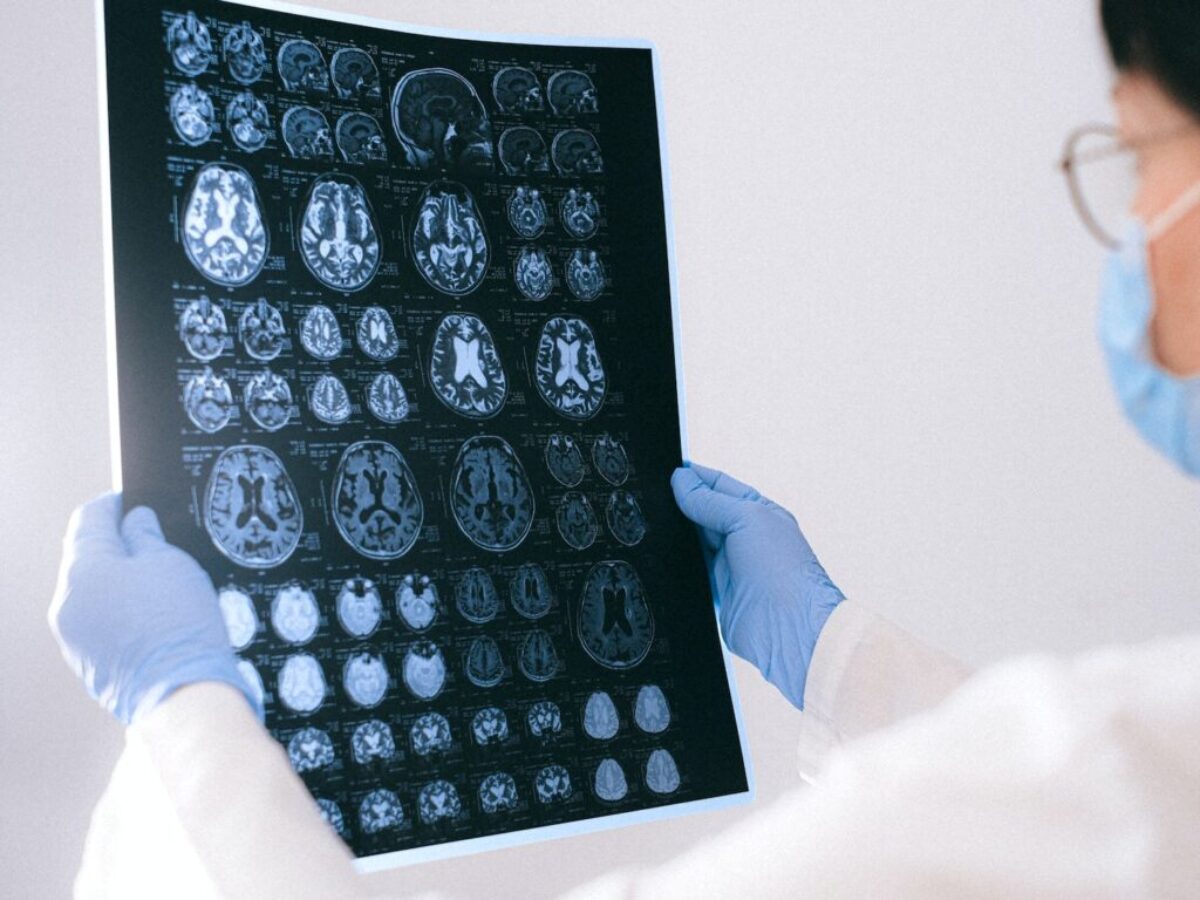 A Doctor Holding an MRI Result of the Brain