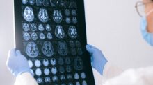 A Doctor Holding an MRI Result of the Brain