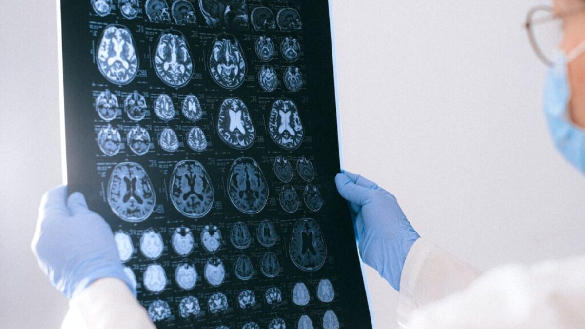A Doctor Holding an MRI Result of the Brain