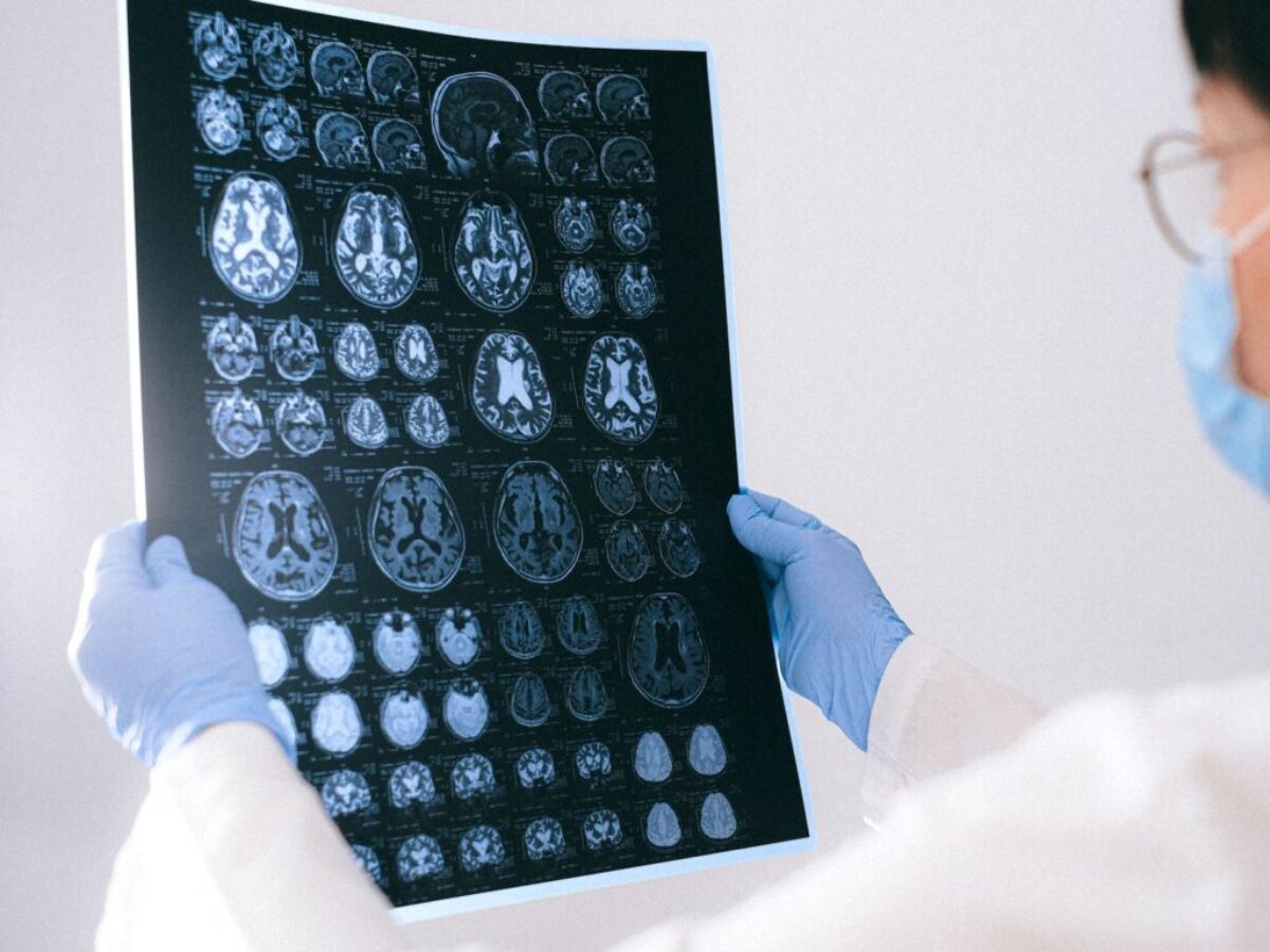A Doctor Holding an MRI Result of the Brain