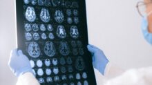 A Doctor Holding an MRI Result of the Brain
