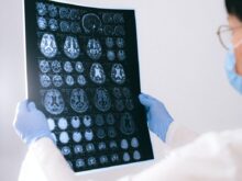 A Doctor Holding an MRI Result of the Brain