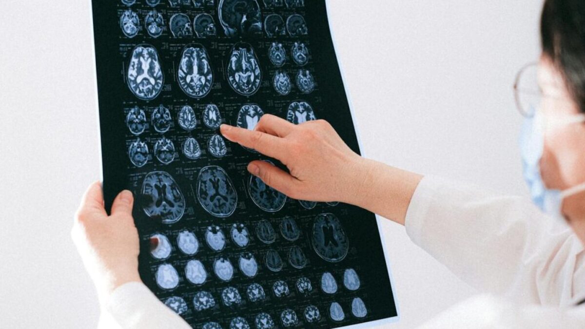 Doctor Pointing to an MRI Scan