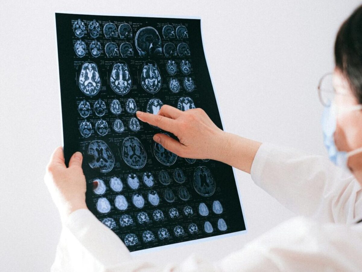 Doctor Pointing to an MRI Scan