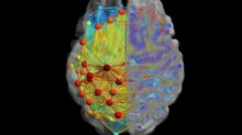 Neurological connections