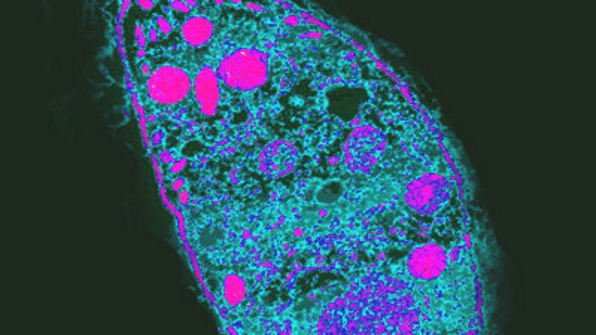 Toxoplasma gondii (2)
