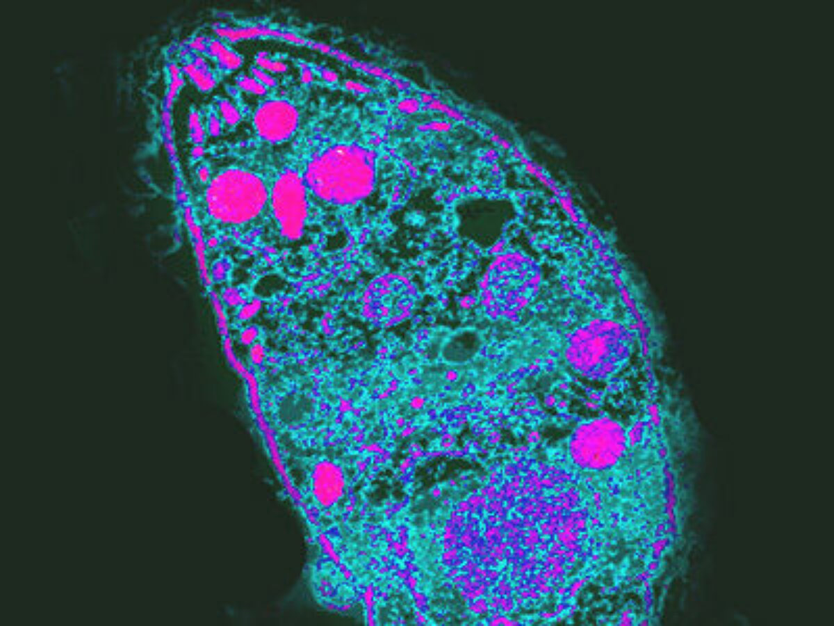 Toxoplasma gondii (2)