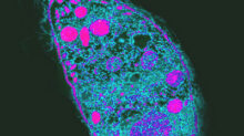 Toxoplasma gondii (2)