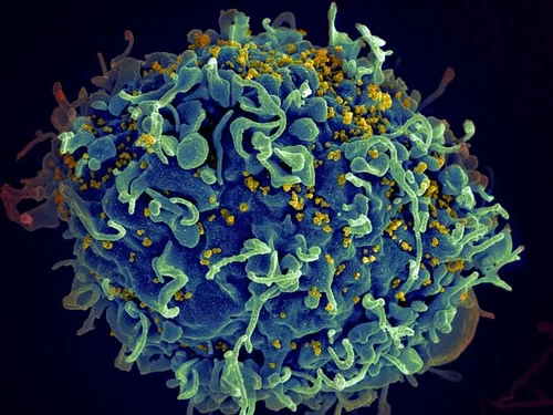 HIV, AIDS - Techsvět