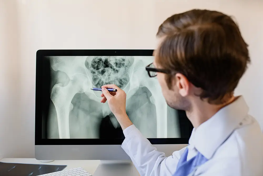 OZP proplatí specializované preventivní vyšetření, které pomáhá včas odhalit osteoporózu. - Techsvět doktor vyšetřuje kosti