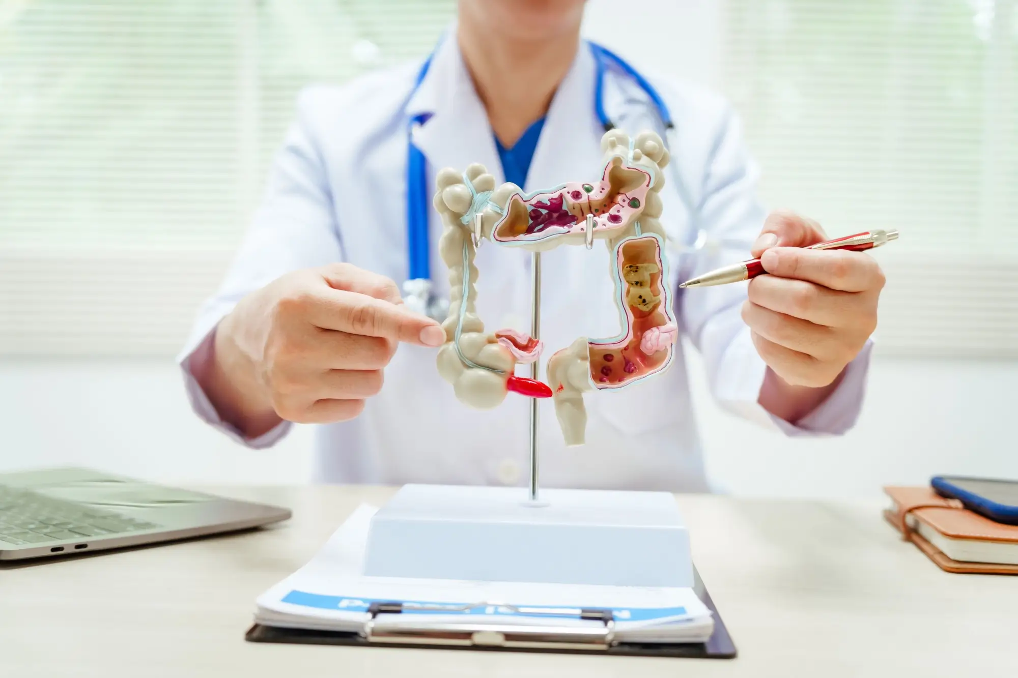 Shutterstock_2554514445 - Techsvět Lékař vysvětluje rakovinu tlustého střeva