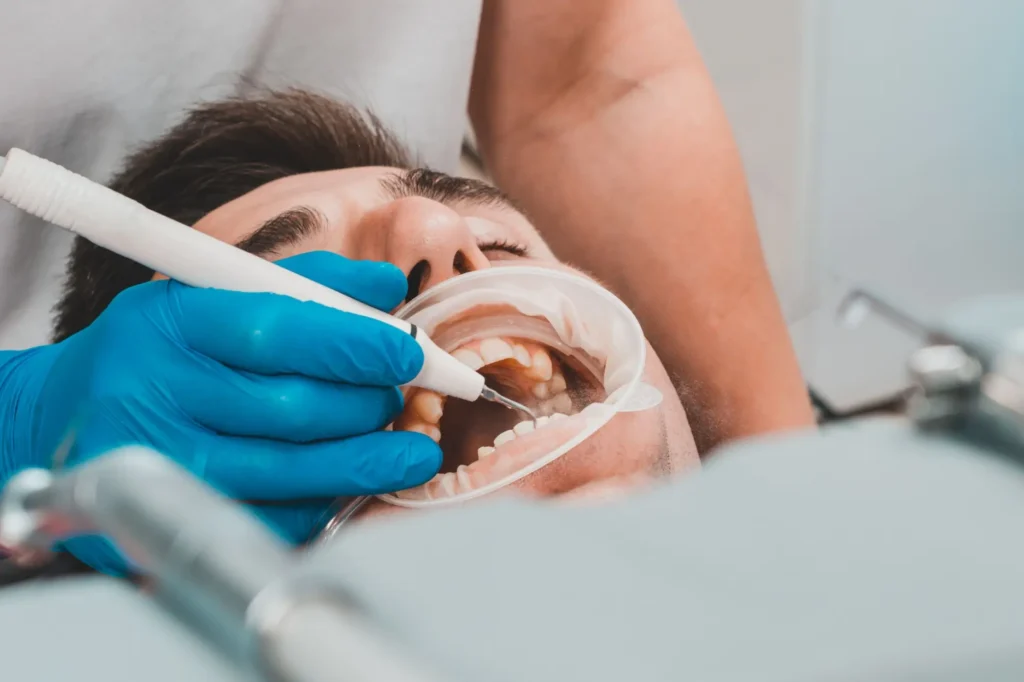 Shutterstock_1859994163 - Techsvět dentální hygiena