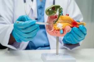 Tělo vám o rakovině slinivky říká několik let dopředu. Nevyplatí se podceňovat varovné signály