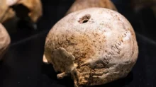 Archeologické objevy ukazují, že neurochirurgii provozovali i staří Inkové.
