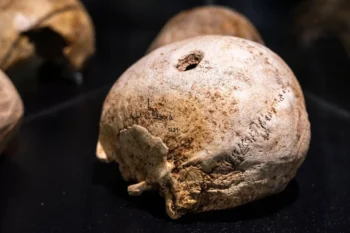 Archeologické objevy ukazují, že neurochirurgii provozovali i staří Inkové.