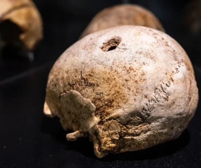 Archeologické objevy ukazují, že neurochirurgii provozovali i staří Inkové.